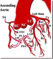 left Coronary Artery